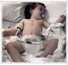 Catheterization 2003 - After