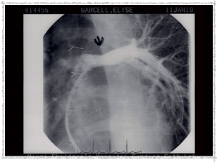 2010 - Before Procedure