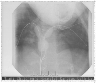 Catheterization 2003 - Before